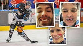 Söllinger (l.) hat nun ein „Eishockey-Lächeln“ wie Kozek und Jagr (o), Romig ließ sich im Sommer ...