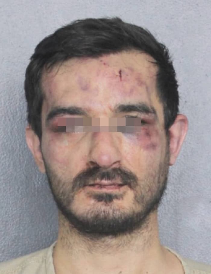 Das Verhaftungsfoto auf der Wache in Wilton Manors zeigte, wie schwer C. hatte einstecken ...