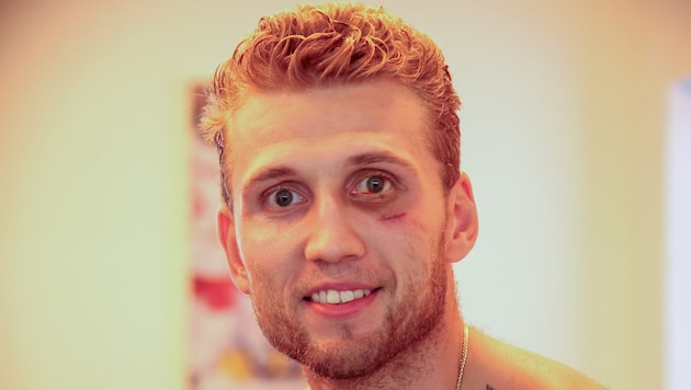 Sah gezeichnet aus, ist jetzt aber wieder fit: Salzburgs Mario Huber.