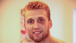 Sah gezeichnet aus, ist jetzt aber wieder fit: Salzburgs Mario Huber.