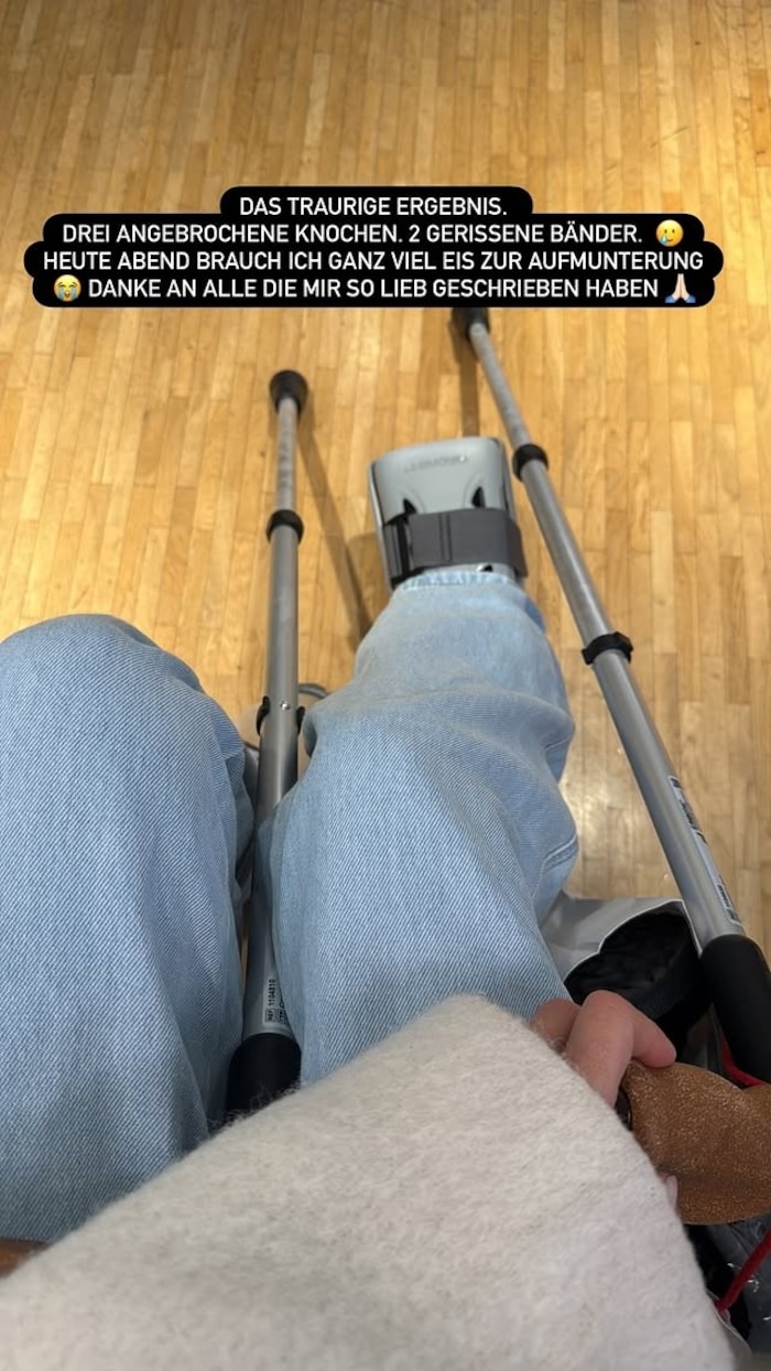 In ihrer Instagram-Story hielt Gercke ihre Fans über ihre Verletzung auf dem Laufenden.