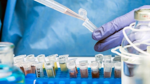 Beim Pharmakonzern Takeda wackeln bis zu 200 Jobs in Wien. Betroffen ist in erster Linie der ...