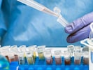 Beim Pharmakonzern Takeda wackeln bis zu 200 Jobs in Wien. Betroffen ist in erster Linie der ...