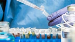 Die neue Variante sorgt für mehr und mehr Fälle, wie sich deutlich auch in der Abwasseranalyse ...