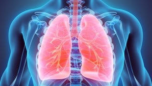 COPD: Kranke Lunge im Fokus.