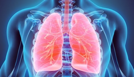 COPD: Kranke Lunge im Fokus.
