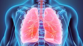 COPD: Kranke Lunge im Fokus.