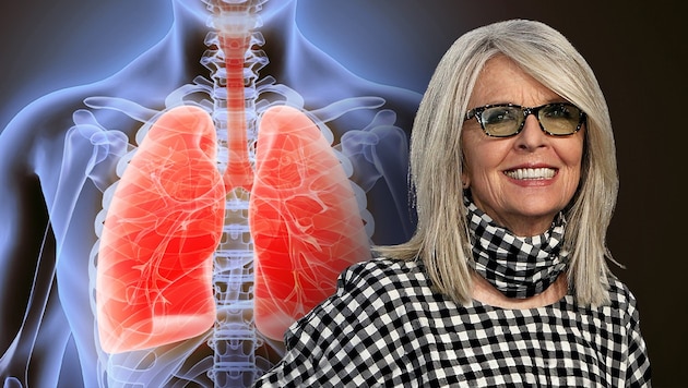 Hollywood-Star Diane Keaton (79) erlag der Atemwegserkrankung.