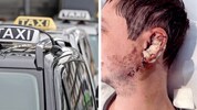 Gleich nach dem Unfall wurde der 28-Jährige in der Innsbrucker Klinik am Ohr operiert.