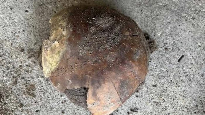 Dieses Stück eines Schädelknochens alarmierte die Ermittler im Fayette County.