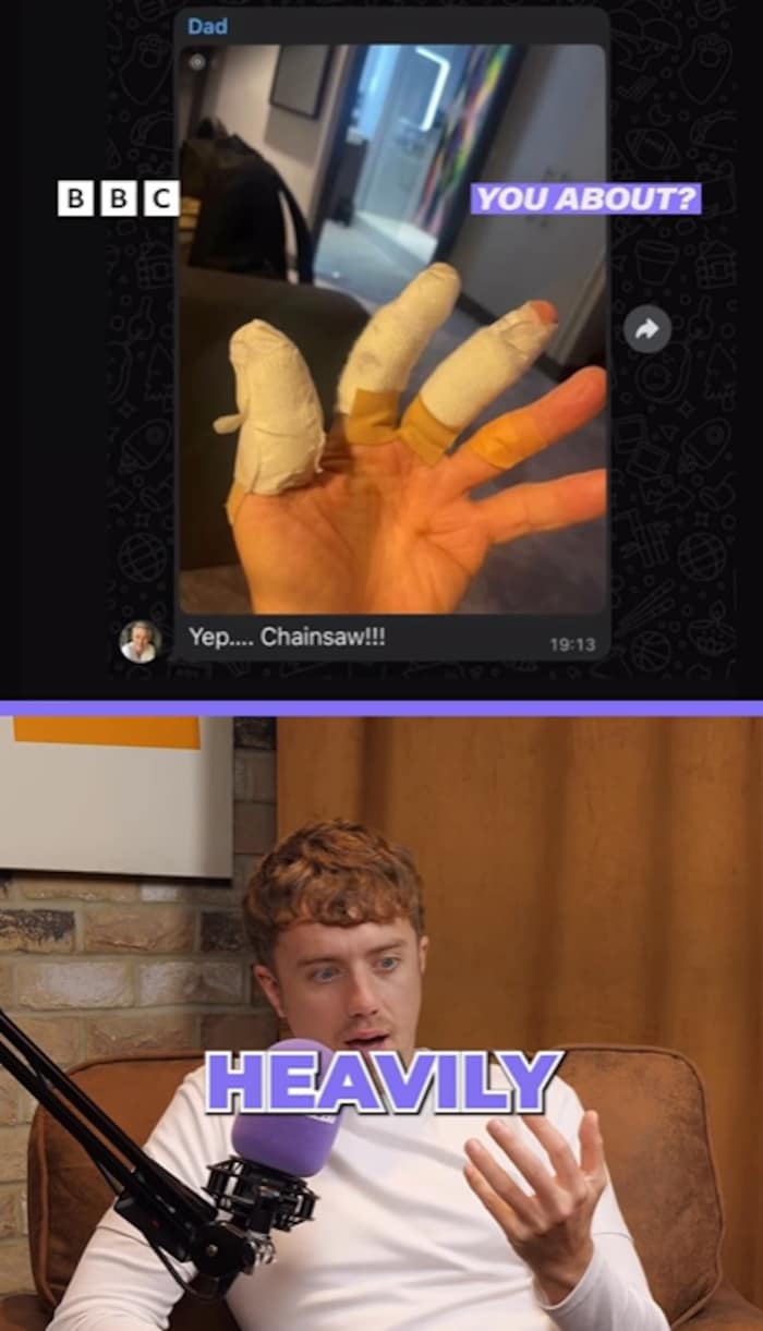 In einem Video auf Instagram zeigt Kemps Sohn das Foto der bandagierten Hand seines Vaters.