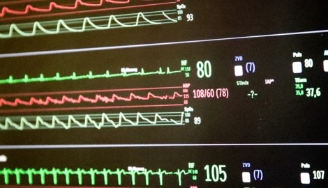 Das Gesundheitssystem läuft derzeit auf einem finanziellen Herzschrittmacher.