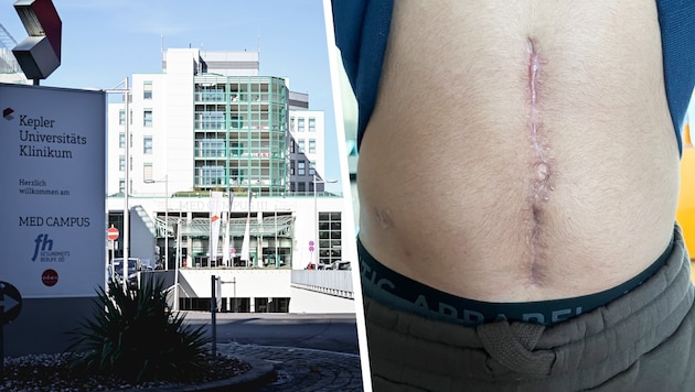 Nachdem der 18-jährige Linzer vom Kepler Uniklinikum heimgeschickt wurde, quälte er sich drei ...