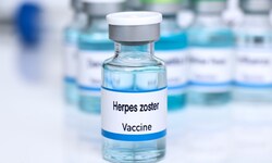 Herpes Zoster wird gegen Gürtelrose geimpft und wird Menschen über 60 Jahren empfohlen.
