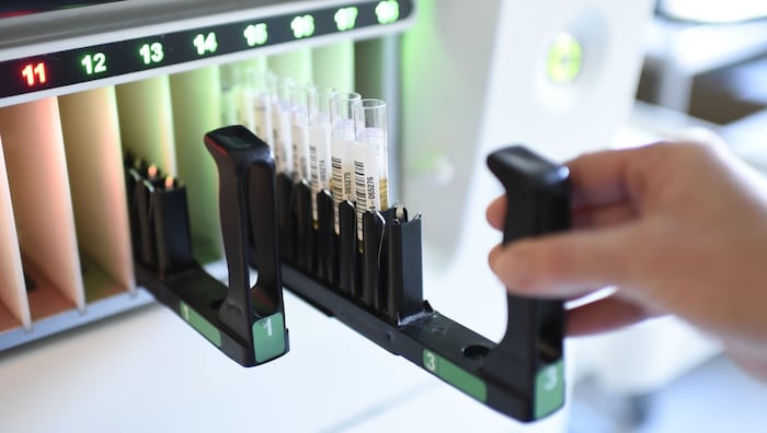 Bei 23 Kindern wurde die Genmutation bisher nachgewiesen (Symbolbild).