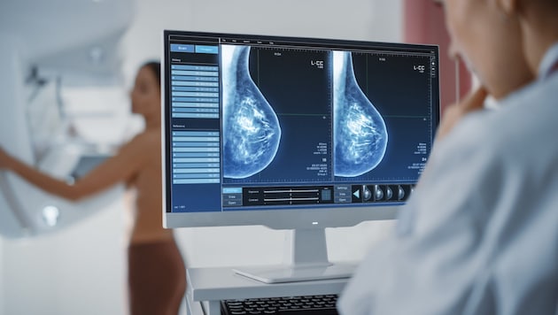 Im Landesklinikum Horn wird bei der Diagnose Brustkrebs jetzt eine neue, schonende ...