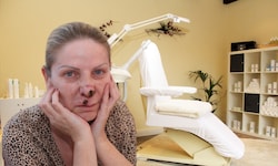 „Nasen-Opfer“ Snezana nach der Behandlung in einer Wiener Schönheitsklinik. Sie leidet heute ...