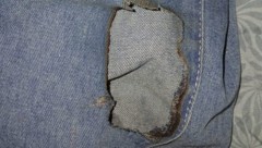 Dieses Bild der angesengten Hose des Burschen postete die Mutter.