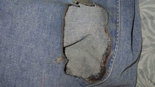 Dieses Bild der angesengten Hose des Burschen postete die Mutter.