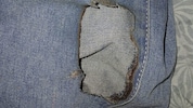 Dieses Bild der angesengten Hose des Burschen postete die Mutter.