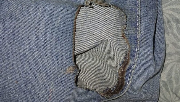 Dieses Bild der angesengten Hose des Burschen postete die Mutter.