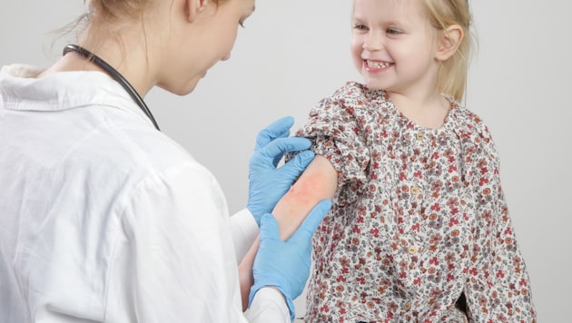 Chronische Hautleiden sind mitunter erblich bedingt.