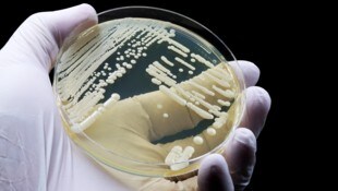 Den Pilz kann man jahrelang mit sich herumtragen, ohne es zu merken, warnen Forscher.