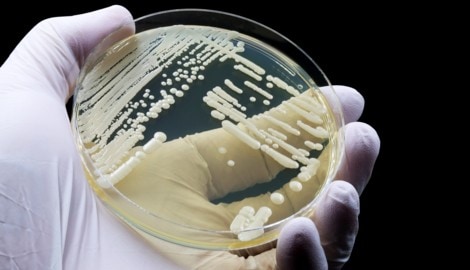 Den Pilz kann man jahrelang mit sich herumtragen, ohne es zu merken, warnen Forscher.