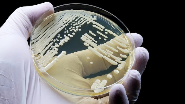 Den Pilz kann man jahrelang mit sich herumtragen, ohne es zu merken, warnen Forscher.