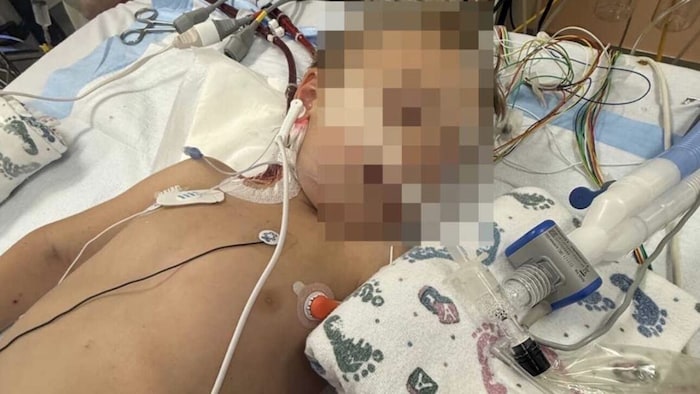 Einer der zwei Buben liegt noch immer auf der Intensivstation. Er musste 25 Minuten lang ...