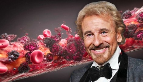 Star-Moderator Thomas Gottschalk leidet unter einem epitheloiden Angiosarkom, einer besonders ...