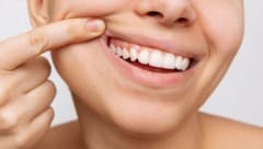 Helles Zahnfleisch sieht nicht nur schöner aus als entzündetes.