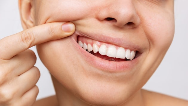 Helles Zahnfleisch sieht nicht nur schöner aus als entzündetes.