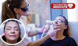 Dr. Barbara Franz macht der Patientin Mut. Die Behandlung mit dem Laser tut nicht sehr weh.