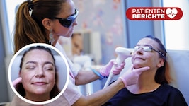 Dr. Barbara Franz macht der Patientin Mut. Die Behandlung mit dem Laser tut nicht sehr weh.