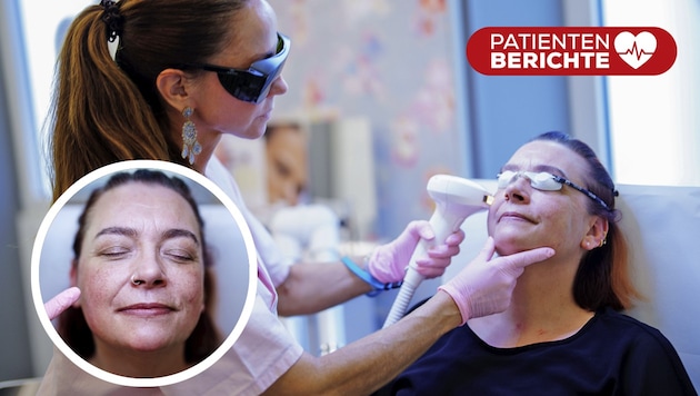 Dr. Barbara Franz macht der Patientin Mut. Die Behandlung mit dem Laser tut nicht sehr weh.