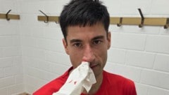 Hatte mit Nasenbluten zu kämpfen: Squasher Aqeel Rehman.