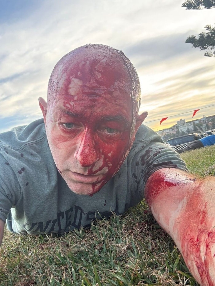 Arsen Ostrovsky postete ein Selfie mit blutigem Kopf.