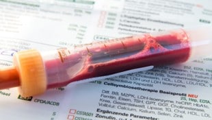 Ihr Blut verrät viel über Ihre Gesundheit.