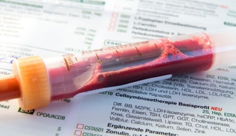 Ihr Blut verrät viel über Ihre Gesundheit.