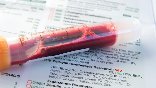 Ihr Blut verrät viel über Ihre Gesundheit.