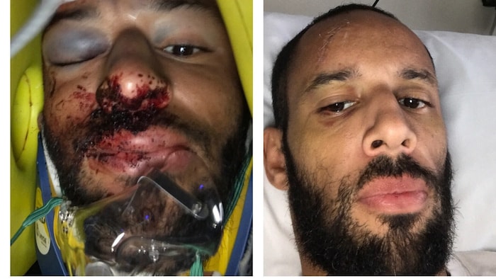 2017 wurde der Leichtathlet bei einem Verkehrsunfall schwer verletzt. Es dauerte Jahre, bis die ...