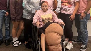 Das linke Bein von Jasmin war schwerer als ihr restlicher Körper. 