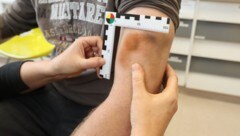 Die Spezialisten an der Grazer Med Uni dokumentieren Spuren von Misshandlungen möglichst zeitnah ...
