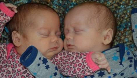 Annabelle und Silas sorgten bei ihrer Geburt für internationale Schlagzeilen – sie kamen viel zu ...