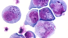 Unter dem Mikroskop: Diese Immunzellen zeigen deutliche Spuren einer Infektion mit dem ...