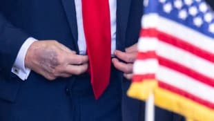 Die mysteriösen Hauterscheinungen an Trumps Händen waren schon oft Thema – und ließen über ...