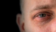 Gewalt gegen Männer wird oft nicht zur Anzeige gebracht.