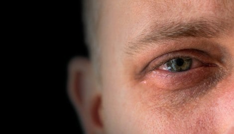 Gewalt gegen Männer wird oft nicht zur Anzeige gebracht.