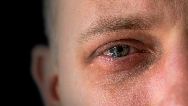 Gewalt gegen Männer wird oft nicht zur Anzeige gebracht.